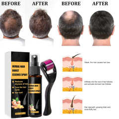 Kit de tratament avansat pentru creșterea părului 30ml 2PCS, spray pentru creșterea părului, set de role și esențe pentru creșterea părului, ser pentru creșterea părului, împotriva căderii părului, ser pentru creșterea avansată a părului Ingrijirea parului Naty Shop