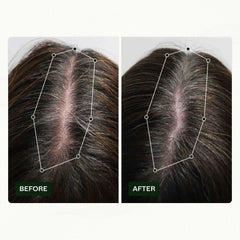 Scandinavian Biolabs Hair Growth Routine pentru femei cu rezultate dovedite clinic în 45 de zile | Tratamentul pentru căderea părului (Bio-Pilixin) Ingrijirea parului Naty Shop