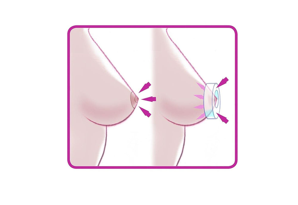 ELANEE Brust-Ringe, Schutz Der Brustwarze Bh-Kontakt Durch Hohllagerung, Ideal Bei Wunden, Entzündeten Brustwarzen Durch Stillen, 10 Stück (222-00) Tilbehør Mad og Amning Bebe Naty Shop