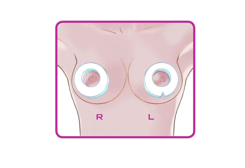 ELANEE Brust-Ringe, Schutz Der Brustwarze Bh-Kontakt Durch Hohllagerung, Ideal Bei Wunden, Entzündeten Brustwarzen Durch Stillen, 10 Stück (222-00) Tilbehør Mad og Amning Bebe Naty Shop