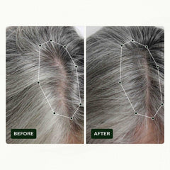 Scandinavian Biolabs Hair Growth Routine pentru femei cu rezultate dovedite clinic în 45 de zile | Tratamentul pentru căderea părului (Bio-Pilixin) Ingrijirea parului Naty Shop