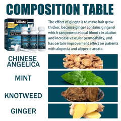 Miioto ser de creștere a părului, produs de creștere a părului pentru bărbați, ser de păr pentru creșterea părului, îngrijirea scalpului promovează părul mai gros hrănește scalpul și previne căderea părului, 3 * 60 ML Ingrijirea parului Naty Shop